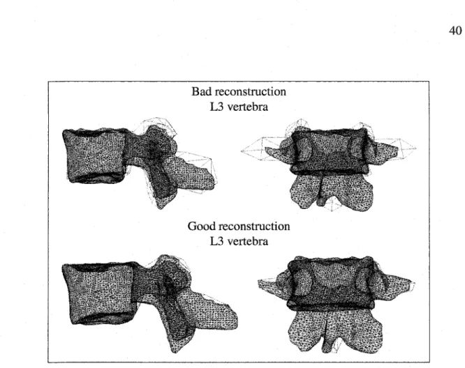 Figure 13  Visual  comparison  between  3D  reconstruction  using  our  3D/2D  registration  method (red lines) and reference CT-scan (black lines) for the L3 vertebra  as an original 3D/2D reconstruction or segmentation model