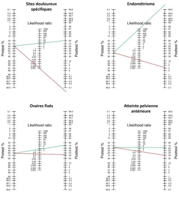 Figure 9: Nomogrammes de Fagan des différents items de l'examen échographique dans la  prédiction du geste chirurgical 