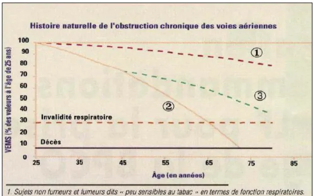 Figure 8 : Histoire naturelle de l’obstruction chronique de voies aériennes. Courbe de  Fletcher [39]