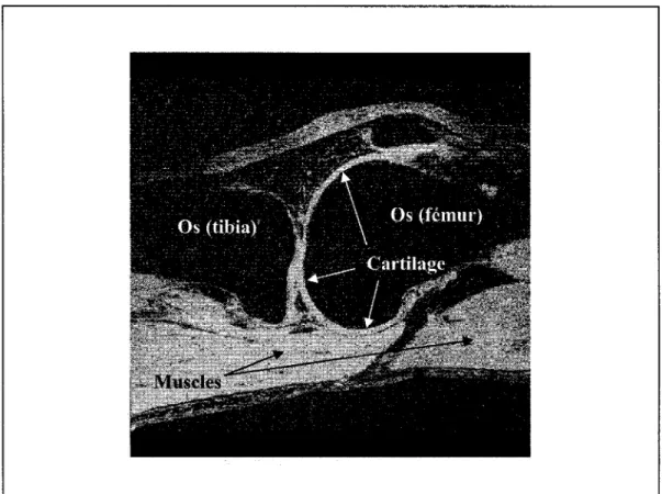Figure 2  Image IRM d'une coupe du cartilage du  genou droit de  M.  Rémi  Lavoie. 