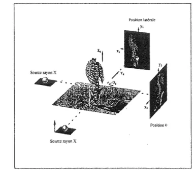 Figure 2  Acquisition des radiographies à rayons X selon deux différentes vues 