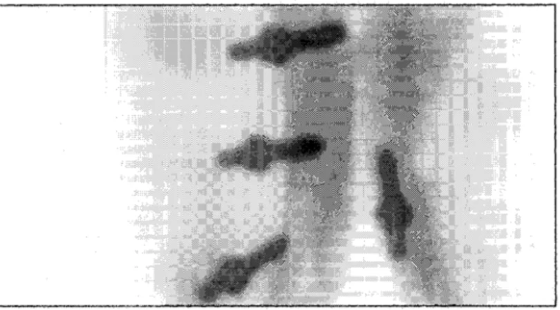 Figure 9  Les contours de vis par la méthode de Canny 