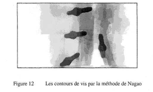 Figure 12  Les contours de vis par la méthode de N agao 