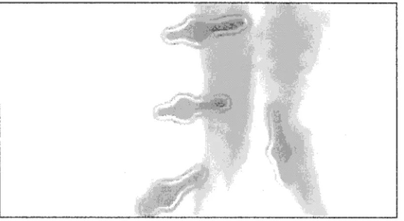 Figure 16  Les contours des  vis par l'EDP d'Alvarez, Lions et Morel 