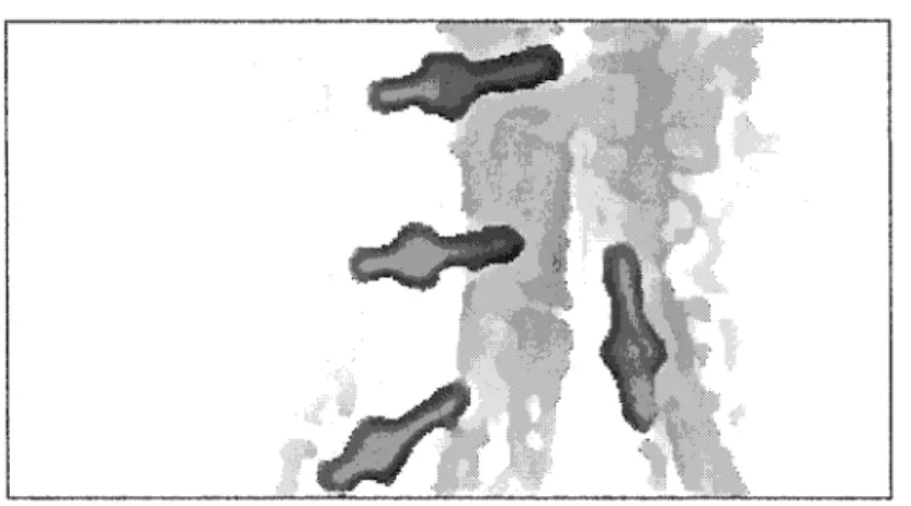 Figure 19  Segmentation de vis par le filtre de choc d'Alvarez 