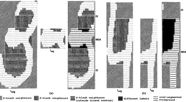 Figure  25  Two  samples  (a  and  b)  of Multi-level  Concavity  Analysis  (MCA)  and  Contextual  Information  (CI)