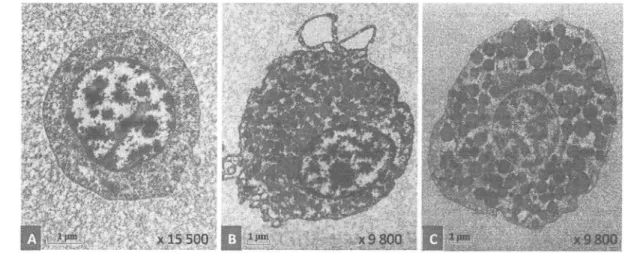 Figure  5 : Hémocytes  de  Mytilus  edulis  classés  comme  :  A)  Hyalinocyte  typique  ne contenant peu ou  pas de  granules,  B)  Granulocytes contenant  des  petites granules  et  C)  Granulocytes  contenant  de  grandes granules  (Source: Pipe,  1990a