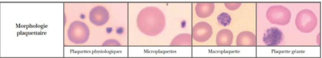 Figure 13 : Variations de taille plaquettaire en microscopie optique. 
