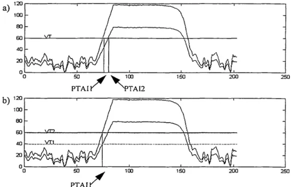 Figure 1.5 Utilisation d'un seuil adaptatif 