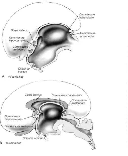 Figure 3 : Formation embryologique des principales commissures inter-hémisphériques 