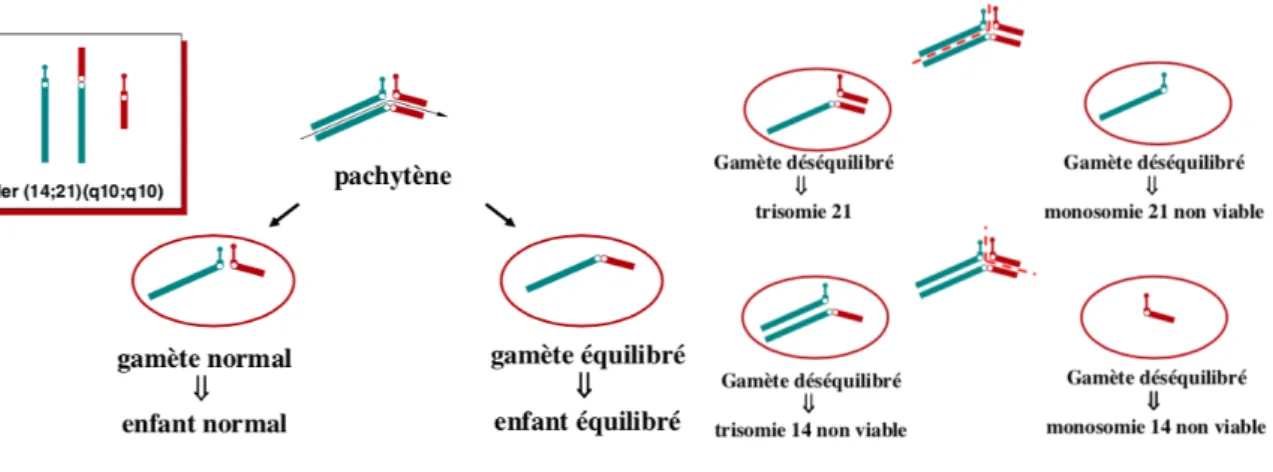 Figure 3 Gamètes issus des différents types de ségrégation lors d’une translocation Robertsonienne rob(14;21)  La ségrégation alterne (à gauche) produit un gamète normal ou un gamète avec translocation équilibrée