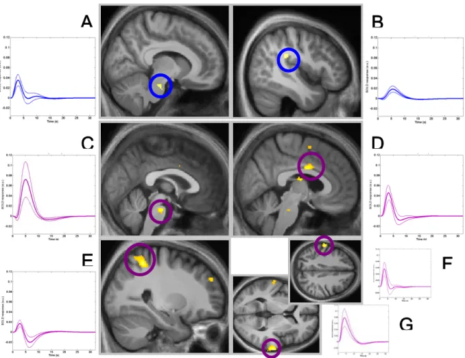 Fig. 1. Brain regions activated in relation to SW onset. Middle panel: Significant  activity in young (blue) and older (purple) subjects, displayed at P &lt; 0.01  (uncorrected)
