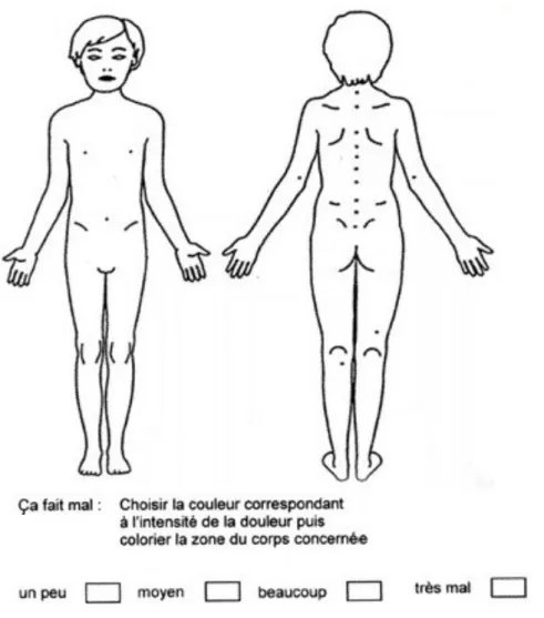 Figure 4 : Les localisations sur schéma  6.2.1.5  L’Echelle Verbale Simple 