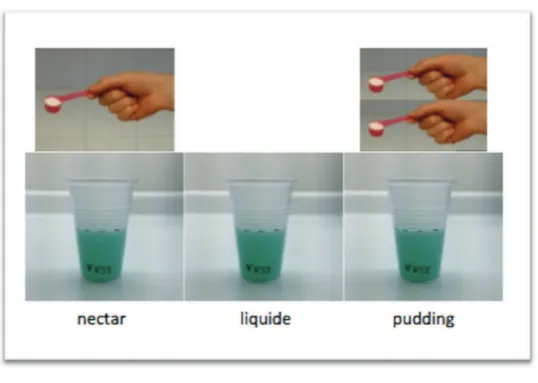 Figure 2 : Volume dÕŽpaississant pour la prŽparation des textures du Ç V-VST È 