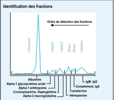 Figure 1: Profil électrophorétique normal 