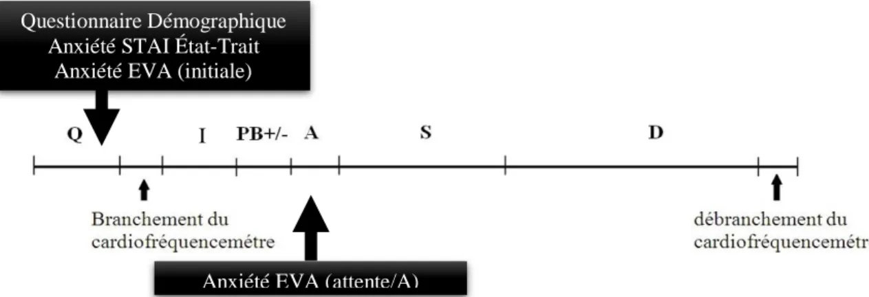 Figure 8. Chronologie de l’application des questionnaires d’anxiété. A : attente ; I : phase initiale ;  D : débriefing ; EVA : échelle visuelle analogique ; PB+/- : étape de pré-briefing ; S : simulation