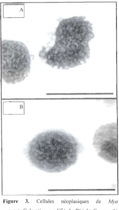 Figure  3.  Cellules  néoplasiques  de  Mya  arenaria.Coloration  modifié  de  Wright  Gemsa