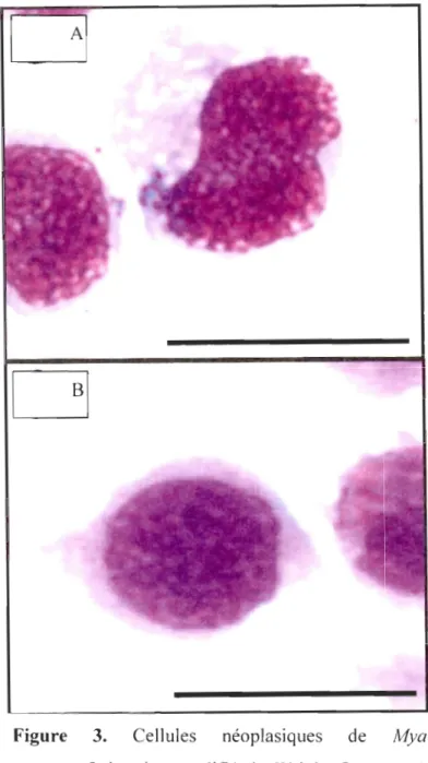 Figure  3.  Cellules  néoplasiques  de  Mya  arenaria.Coloration  modifié  de  Wright  Gemsa