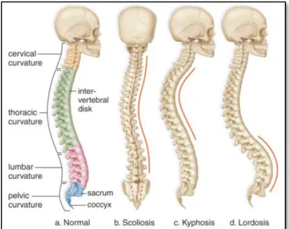 Figure 1.2    Spines and its abnormal curvatures. 