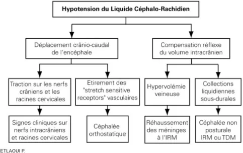 Figure 2 : Physiopathologie de l’hypotension du LCR