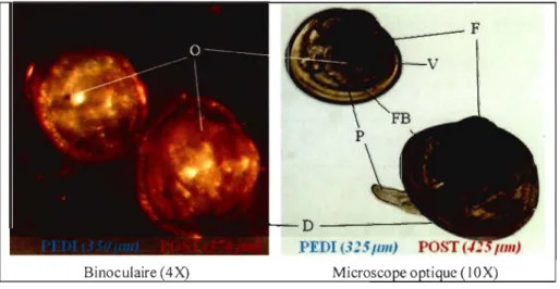 Figure 7 : Comparaison visuelle entre une  larve pédivéligère et une  post-larve de  Mytilus  edulis 