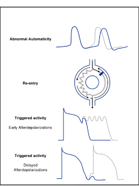 Figure 31 : Résumé des différents mécanismes d’arythmies   (D’après cardiac arrhythmias de S