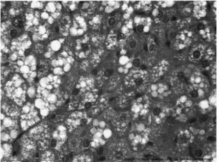 Figure 7 : tissu adipeux brun avec adipocytes comprenant de nombreuses petites vacuoles lipidiques