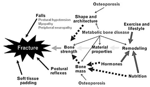 Figure 4 : Etiologies des fractures chez les patients atteints de Maladie Rénale  Chronique