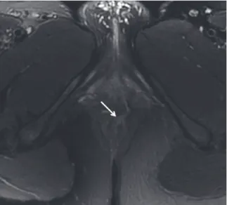 Figure 13- Patiente de 38 ans.   