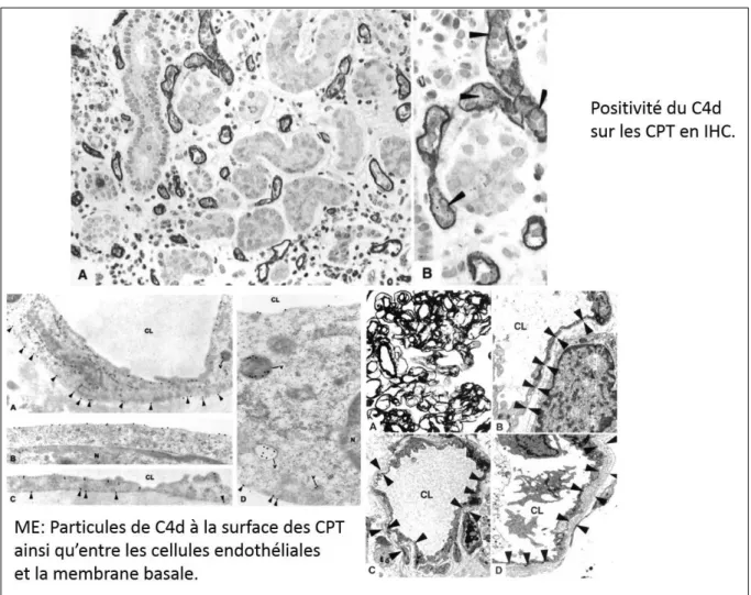 Figure  5 :  Aspect  du  marquage  du  C4d  sur  les  CPT  en  IHC  et  en  microscopie électronique [19]