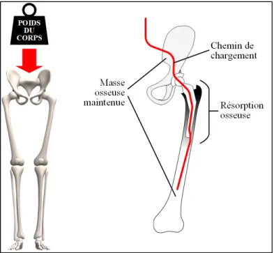 Figure 1.3 Représentation schématique simplifiée de  la déviation des contraintes et de la résorption osseuse 