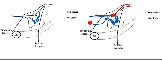 Figure 6 : représentation schématique du triangle de Koch avec la voie lente et la voie rapide au sein du NAV