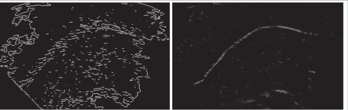 Figure 2.6 Left: shows the result of applying the Canny edge detector on the example US image