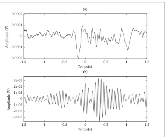 Figure 1.5 Fuseau en EEG : Le signal de l’électrode Cz (données du sujet PL06 d’un protocole de sommeil) (a) le signal de Cz (b) le signal de Cz ﬁltré 11-15 Hz