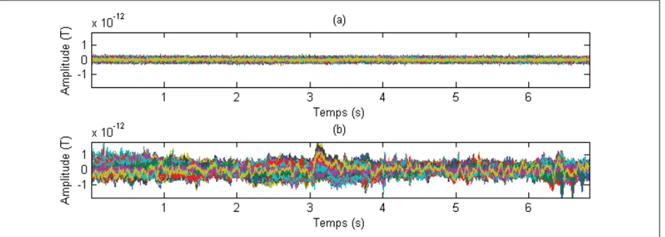 Figure 2.1 Enregistrements MEG de bruit «à vide» et de bruit physiologique (a) Enregistrement «à vide» (b) Enregistrement de bruit physiologique