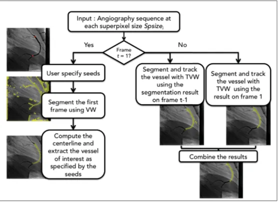 Figure 4.5 Proposed pipeline for spatio-temporal segmentation of an artery in 2D X-ray angiogram
