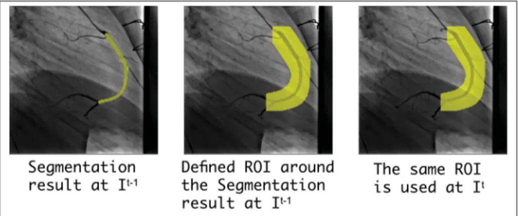 Figure 4.8 The deﬁned region of interest (ROI) for sink nodes selection.