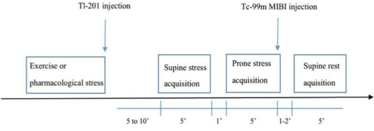 Figure 2. Study imaging protocol with time to acquisition, time to rest injection and duration of  acquisition