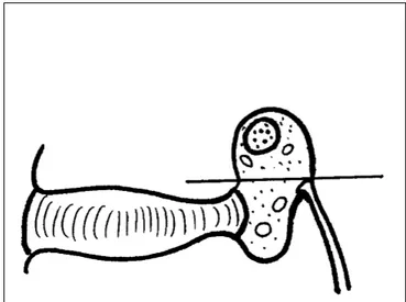 Figure 14 : Anatomie du foramen, partie supérieure contenant le ganglion spi- spi-nal, et inférieure contenant des éléments vasculaires et graisseux