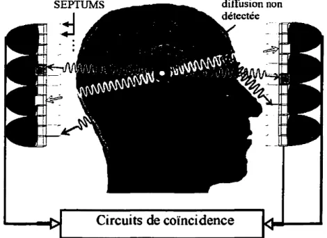 Figure 13 Illustration montrant l'utilité des septums en imagerie 2D en TEP