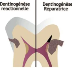 Figure 7 : Représentation de la dentine réactionnelle et réparatrice 