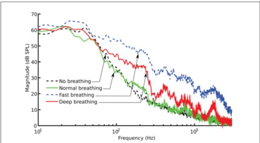 Figure 2.4 Illustrative spectra of four types of nose respiration for one subject, showing different spectral characteristics to