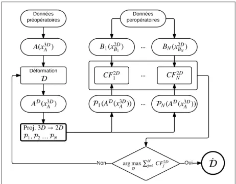 Figure 1.5 Recalage 3D/2D par projection.