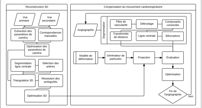 Figure 2.1 Diagramme complet de système de compensation du mouvement cardiorespiratoire.