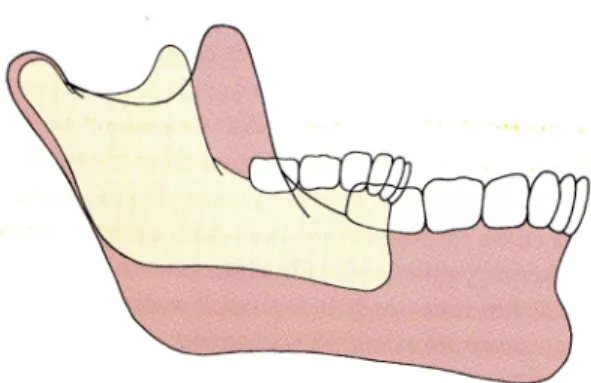 Figure 2.  Croissance mandibulaire telle que vue lorsqu'observée à partir de la base  crânienne