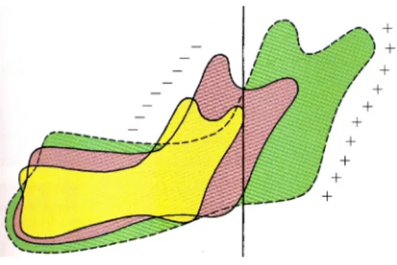 Figure 4.  Remodelage du ramus avec la croissance. 