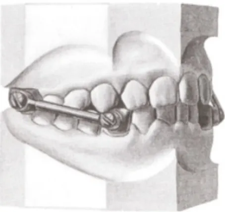 Figure 6.  Appareil de Herbst. 