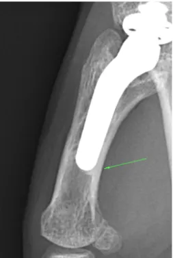 Figure 7 - Piédestal métacarpien en queue de tige 