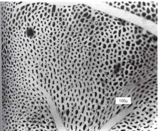 Figure 3.  Surface view of capillaries in alveolar wall(Printed from: Guyton,  A.C. &amp; Hall, J.E., 2006