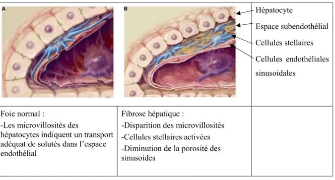 Figure 4 : Travées hépatiques avec sinusoïdes  